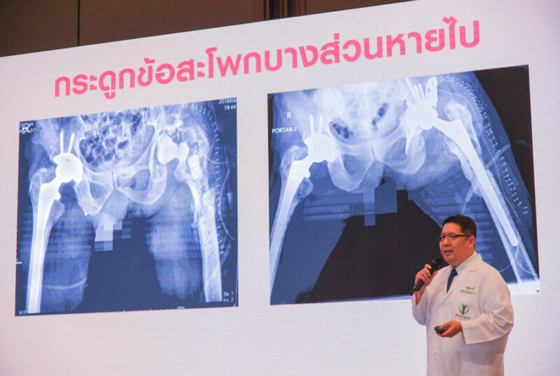 โรงพยาบาลบำรุงราษฎร์